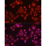 Immunofluorescence - Anti-GALC Antibody (A14482) - Antibodies.com