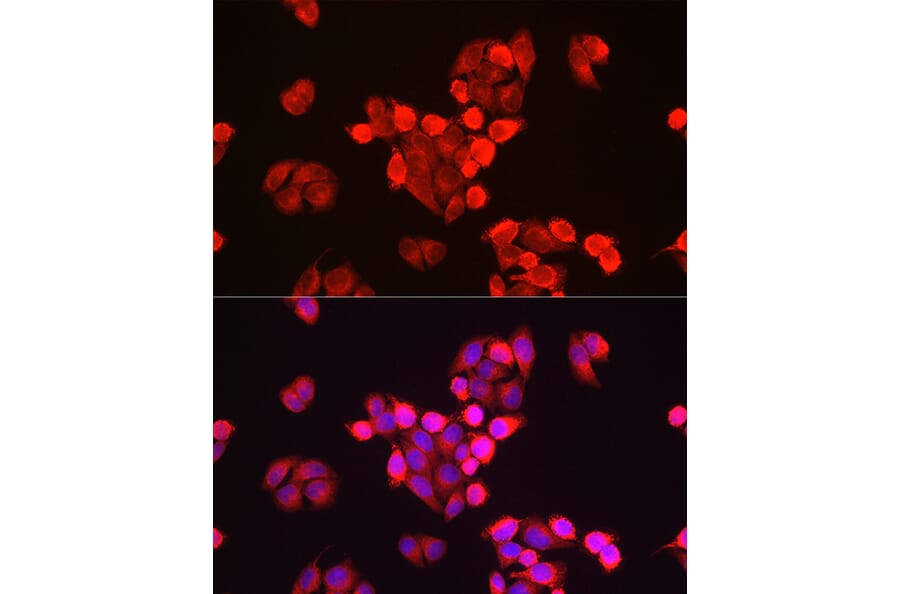 Immunofluorescence - Anti-GALC Antibody (A14482) - Antibodies.com