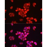 Immunofluorescence - Anti-GALC Antibody (A14482) - Antibodies.com