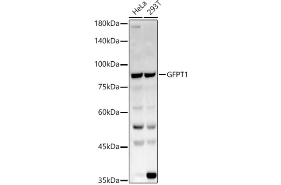 Western Blot - Anti-GFPT1 Antibody (A14483) - Antibodies.com