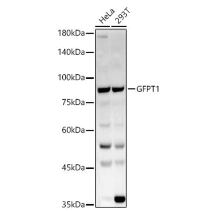 Western Blot - Anti-GFPT1 Antibody (A14483) - Antibodies.com