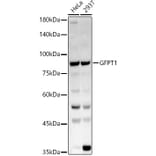 Western Blot - Anti-GFPT1 Antibody (A14483) - Antibodies.com