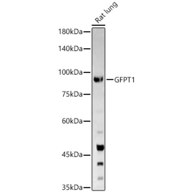 Western Blot - Anti-GFPT1 Antibody (A14483) - Antibodies.com