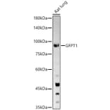 Western Blot - Anti-GFPT1 Antibody (A14483) - Antibodies.com