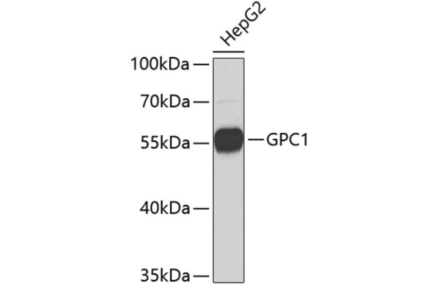 Western Blot - Anti-GPC1 Antibody (A3894) - Antibodies.com