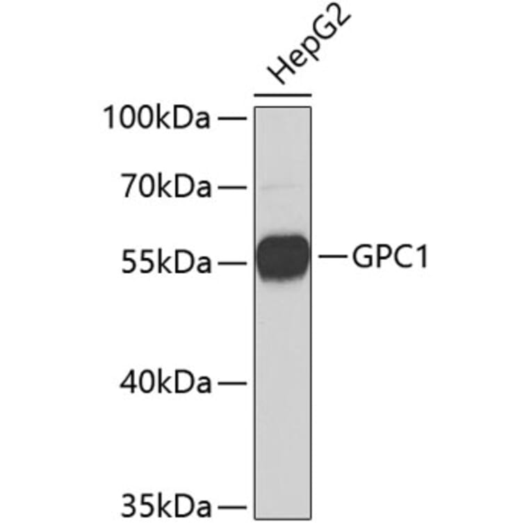 Western Blot - Anti-GPC1 Antibody (A3894) - Antibodies.com