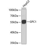 Western Blot - Anti-GPC1 Antibody (A3894) - Antibodies.com