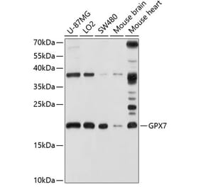 Western Blot - Anti-GPx-7 Antibody (A14485) - Antibodies.com