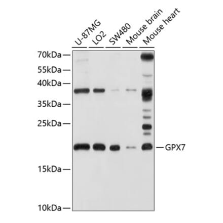 Western Blot - Anti-GPx-7 Antibody (A14485) - Antibodies.com