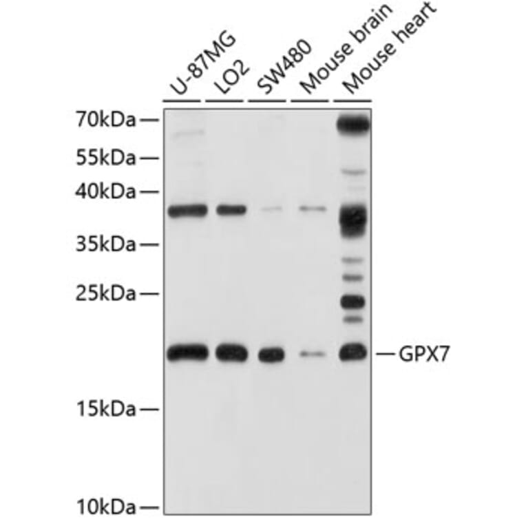 Western Blot - Anti-GPx-7 Antibody (A14485) - Antibodies.com