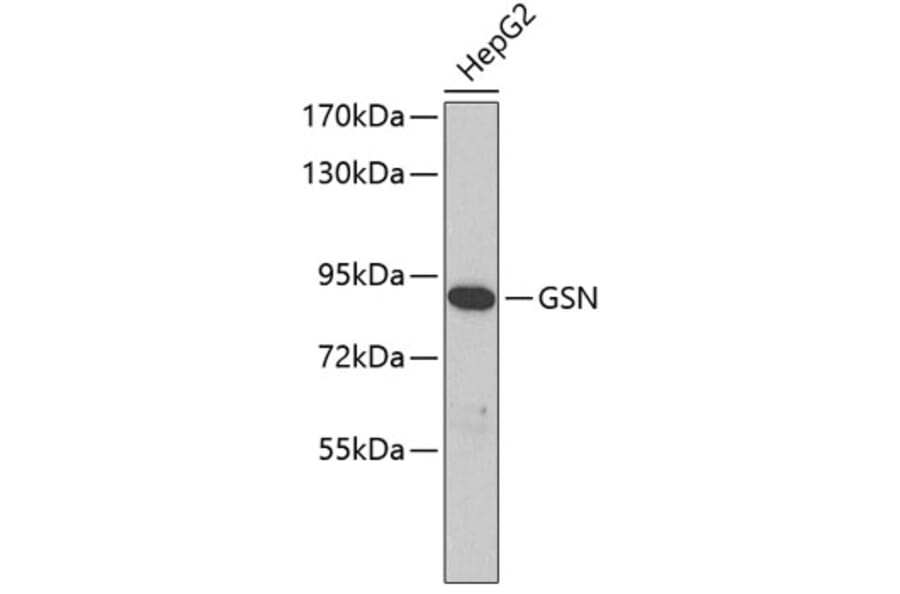 Western Blot - Anti-GSN Antibody (A3903) - Antibodies.com