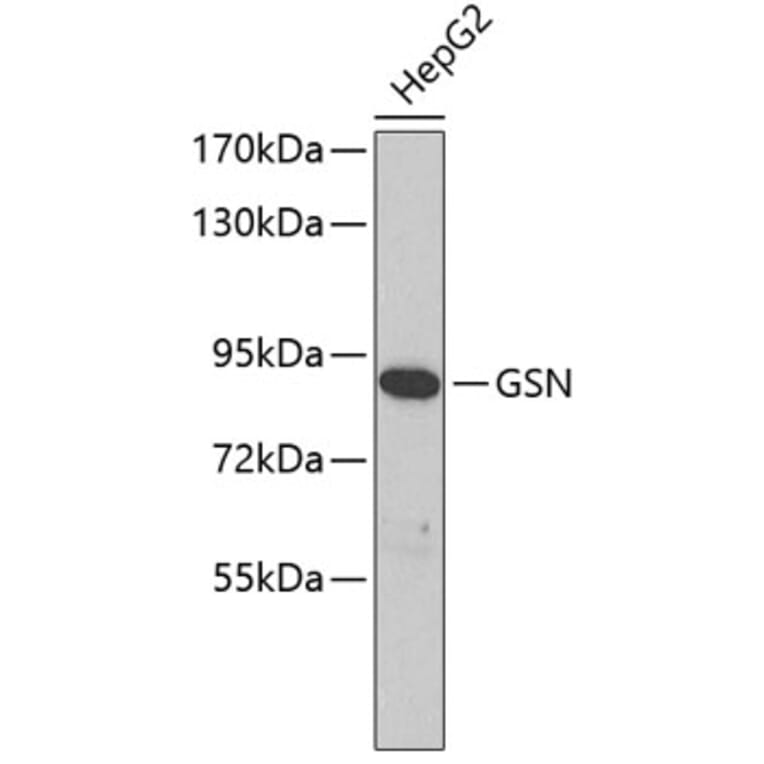 Western Blot - Anti-GSN Antibody (A3903) - Antibodies.com