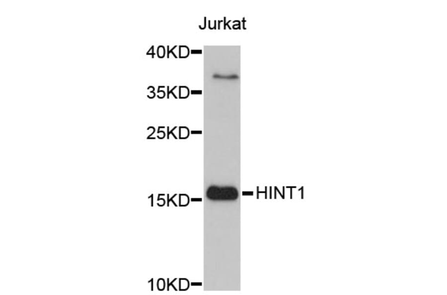 Western Blot - Anti-HINT1 Antibody (A3912) - Antibodies.com