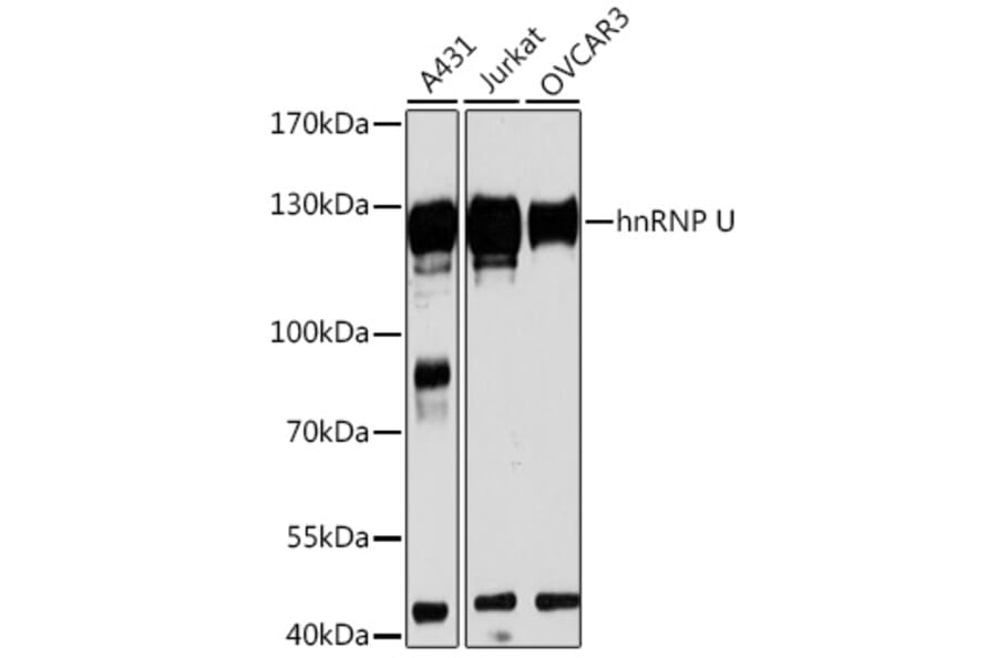 Western Blot - Anti-hnRNP U/p120 Antibody (A14488) - Antibodies.com
