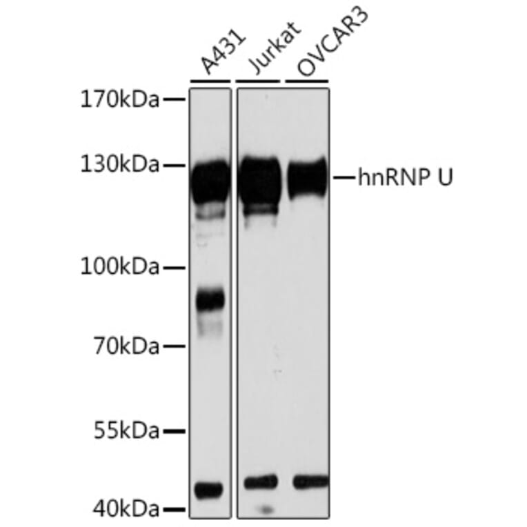 Western Blot - Anti-hnRNP U/p120 Antibody (A14488) - Antibodies.com