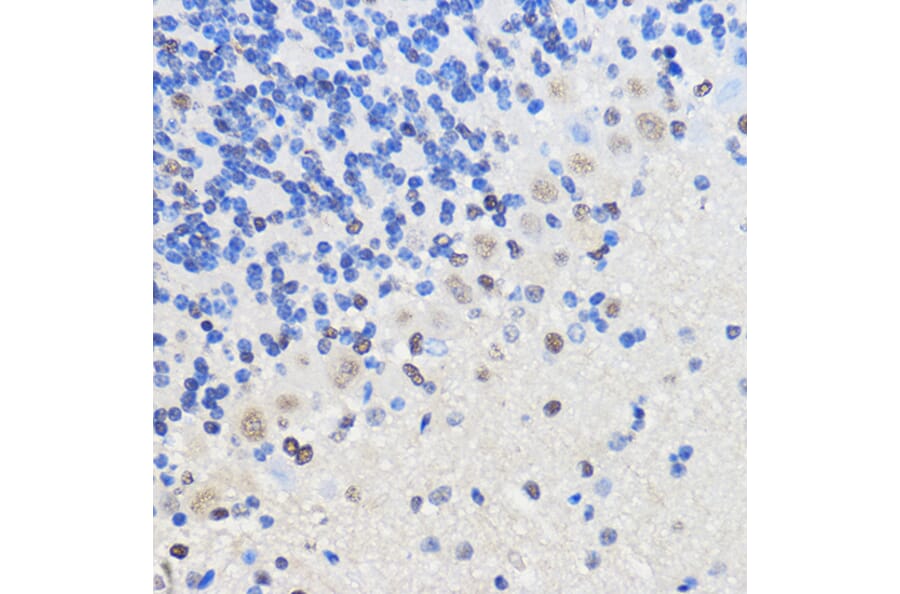 Anti-HNRNPU Antibody (A14488) | Antibodies.com