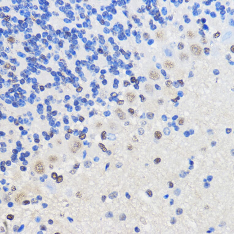 Immunohistochemistry - Anti-hnRNP U/p120 Antibody (A14488) - Antibodies.com