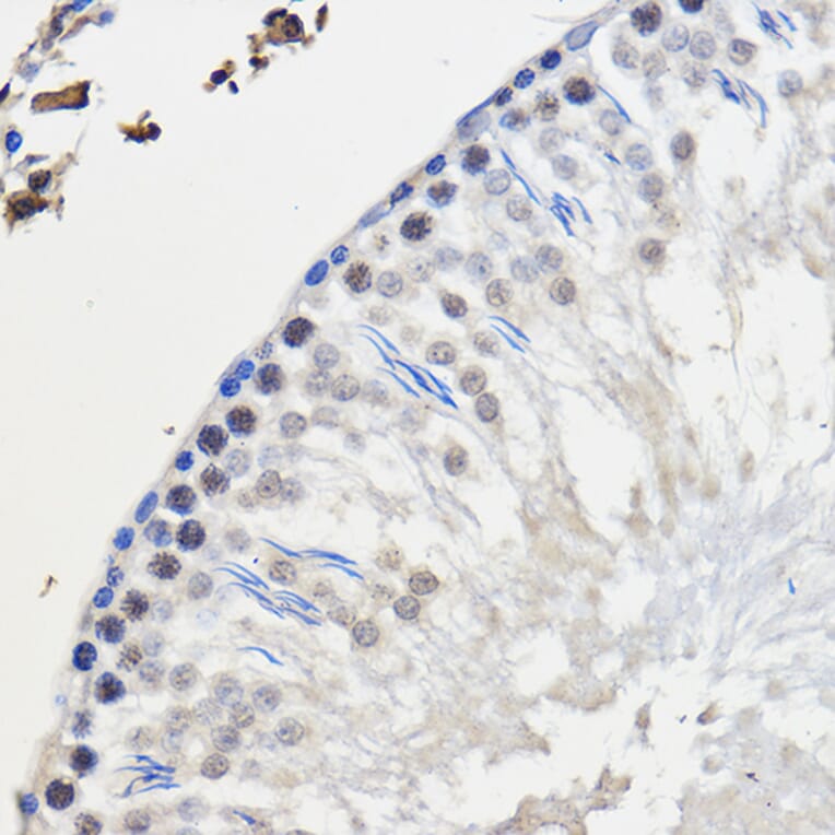 Immunohistochemistry - Anti-hnRNP U/p120 Antibody (A14488) - Antibodies.com