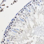Immunohistochemistry - Anti-hnRNP U/p120 Antibody (A14488) - Antibodies.com