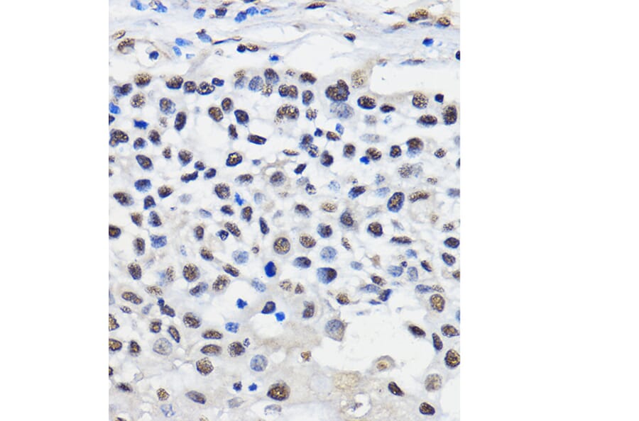 Immunohistochemistry - Anti-hnRNP U/p120 Antibody (A14488) - Antibodies.com