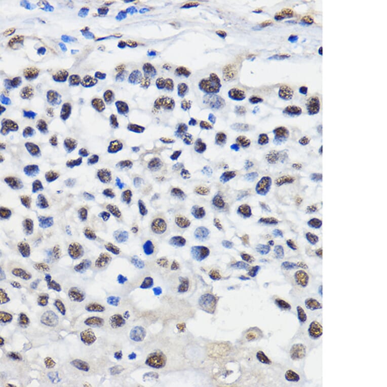 Immunohistochemistry - Anti-hnRNP U/p120 Antibody (A14488) - Antibodies.com
