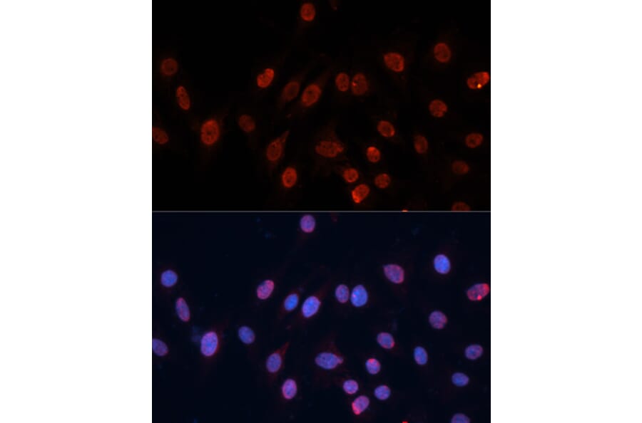 Immunofluorescence - Anti-hnRNP U/p120 Antibody (A14488) - Antibodies.com