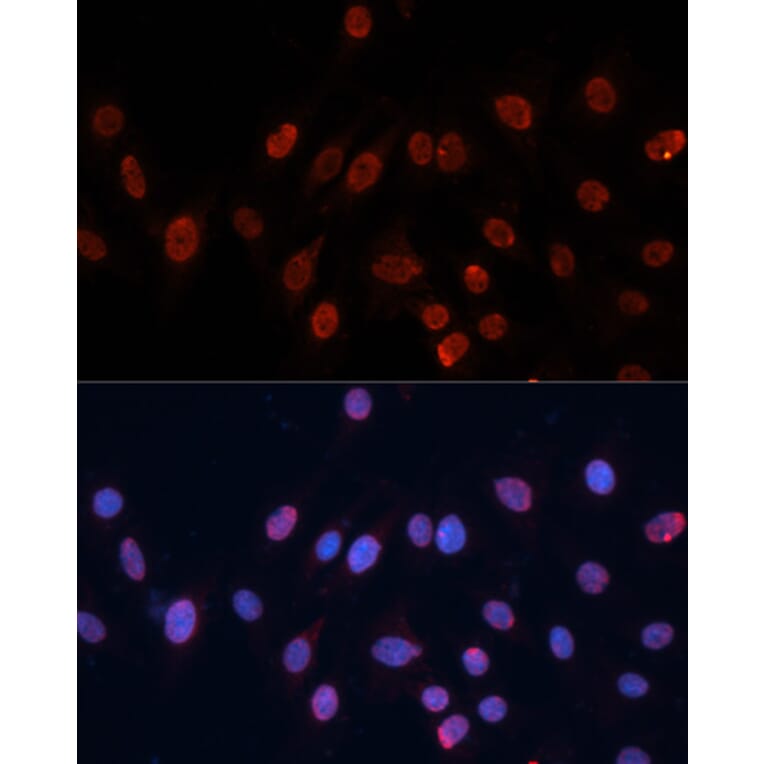 Immunofluorescence - Anti-hnRNP U/p120 Antibody (A14488) - Antibodies.com
