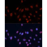 Immunofluorescence - Anti-hnRNP U/p120 Antibody (A14488) - Antibodies.com