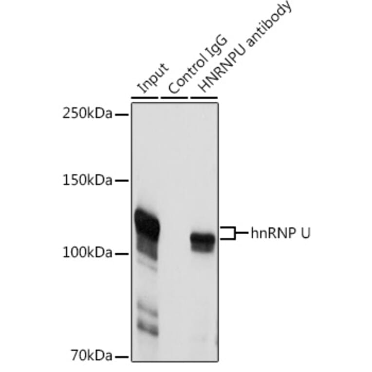 Western Blot - Anti-hnRNP U/p120 Antibody (A14488) - Antibodies.com
