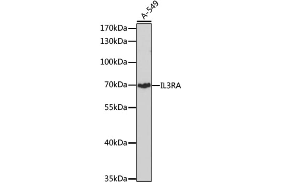 Western Blot - Anti-IL3RA/CD123 Antibody (A14489) - Antibodies.com