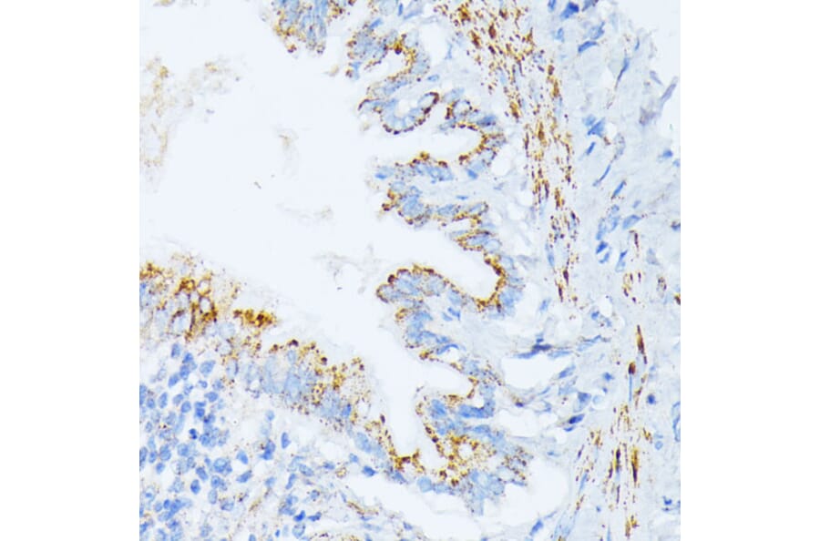 Immunohistochemistry - Anti-IL3RA/CD123 Antibody (A14489) - Antibodies.com