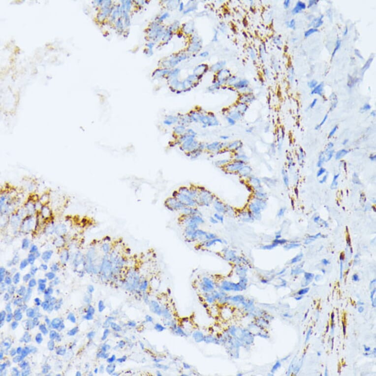 Immunohistochemistry - Anti-IL3RA/CD123 Antibody (A14489) - Antibodies.com