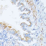 Immunohistochemistry - Anti-IL3RA/CD123 Antibody (A14489) - Antibodies.com