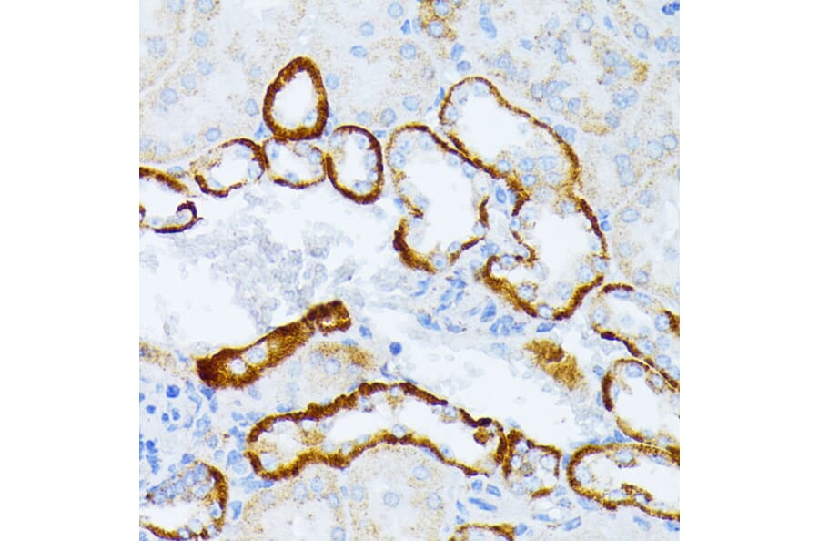 Immunohistochemistry - Anti-IL3RA/CD123 Antibody (A14489) - Antibodies.com