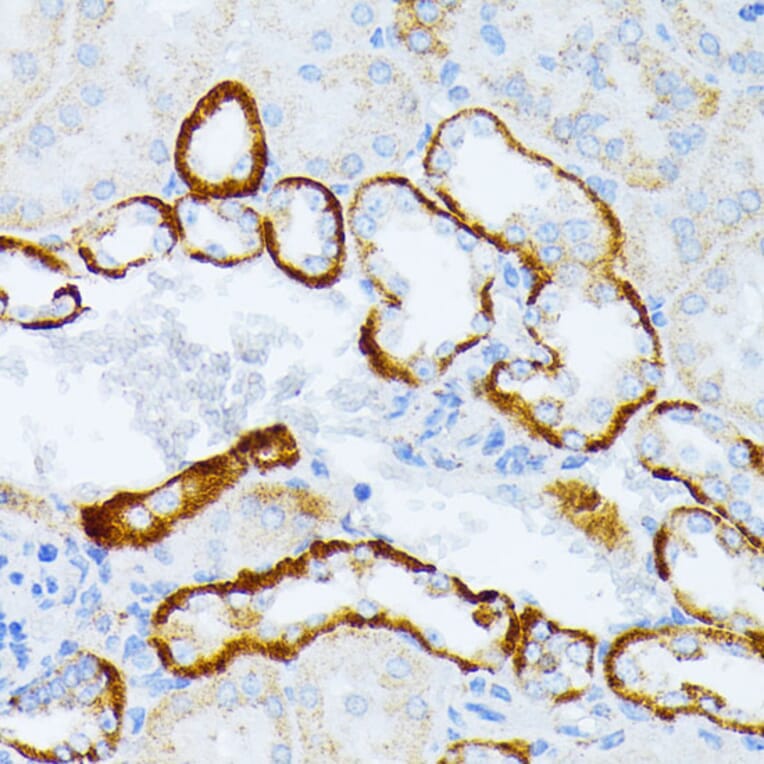 Immunohistochemistry - Anti-IL3RA/CD123 Antibody (A14489) - Antibodies.com