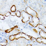 Immunohistochemistry - Anti-IL3RA/CD123 Antibody (A14489) - Antibodies.com