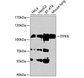 Western Blot - Anti-ITPKB Antibody (A14490) - Antibodies.com