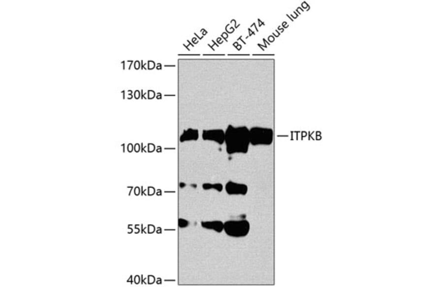 Western Blot - Anti-ITPKB Antibody (A14490) - Antibodies.com
