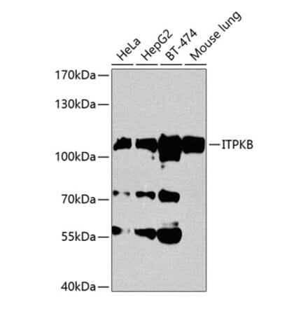 Western Blot - Anti-ITPKB Antibody (A14490) - Antibodies.com