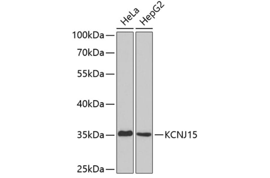 Western Blot - Anti-KCNJ15 Antibody (A3932) - Antibodies.com