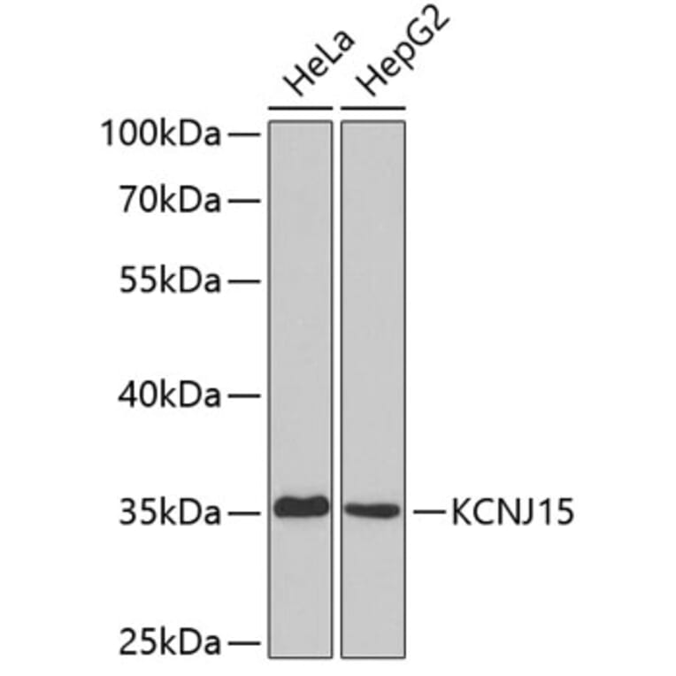 Western Blot - Anti-KCNJ15 Antibody (A3932) - Antibodies.com