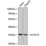 Western Blot - Anti-KCNJ15 Antibody (A3932) - Antibodies.com