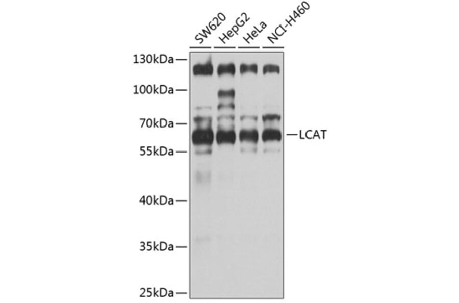 Western Blot - Anti-LCAT Antibody (A3942) - Antibodies.com