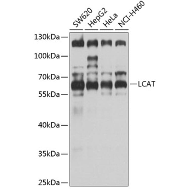 Western Blot - Anti-LCAT Antibody (A3942) - Antibodies.com