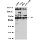 Western Blot - Anti-LCAT Antibody (A3942) - Antibodies.com