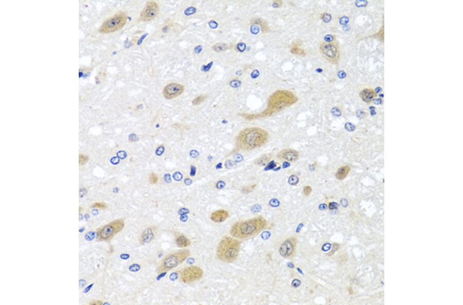 Immunohistochemistry - Anti-LCAT Antibody (A3942) - Antibodies.com