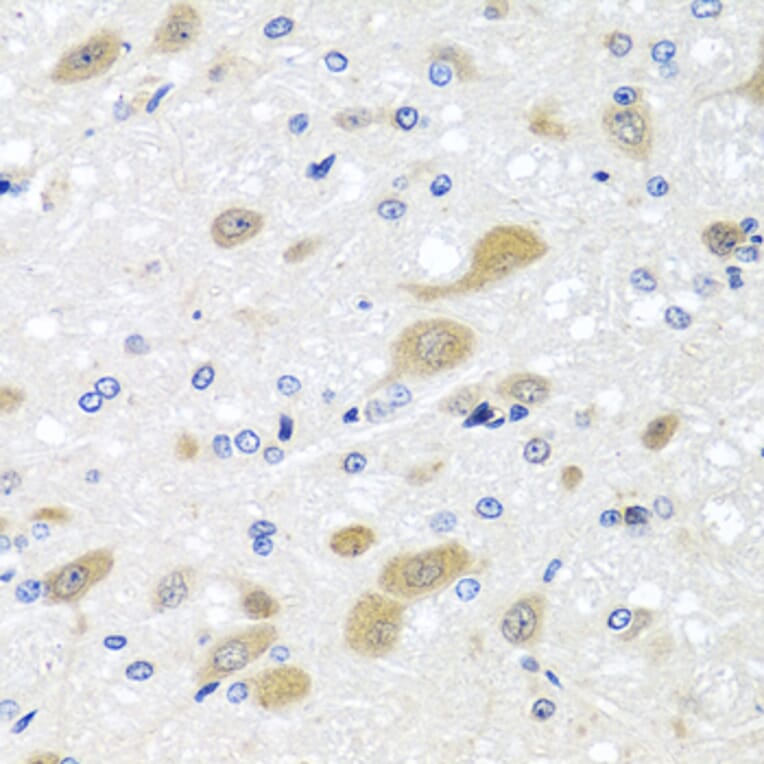 Immunohistochemistry - Anti-LCAT Antibody (A3942) - Antibodies.com
