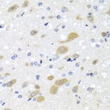 Immunohistochemistry - Anti-LCAT Antibody (A3942) - Antibodies.com