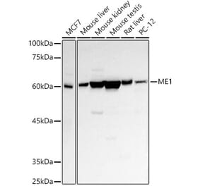 Western Blot - Anti-ME1 Antibody (A14493) - Antibodies.com