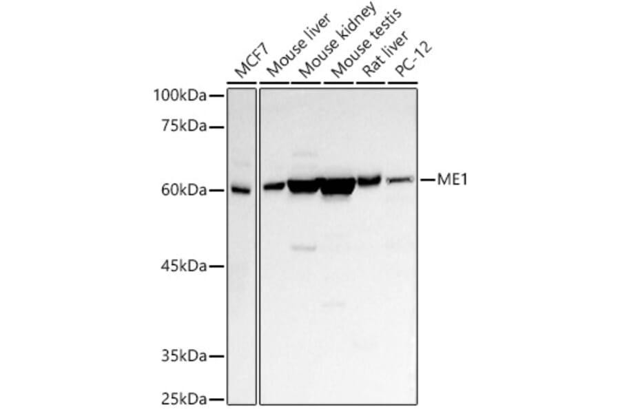 Western Blot - Anti-ME1 Antibody (A14493) - Antibodies.com